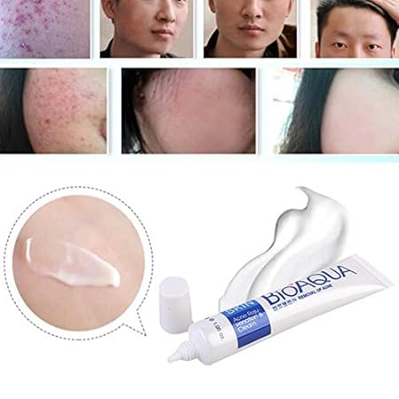 BioAqua acne cream | Bio Aqua Removal of Acne - Image 6